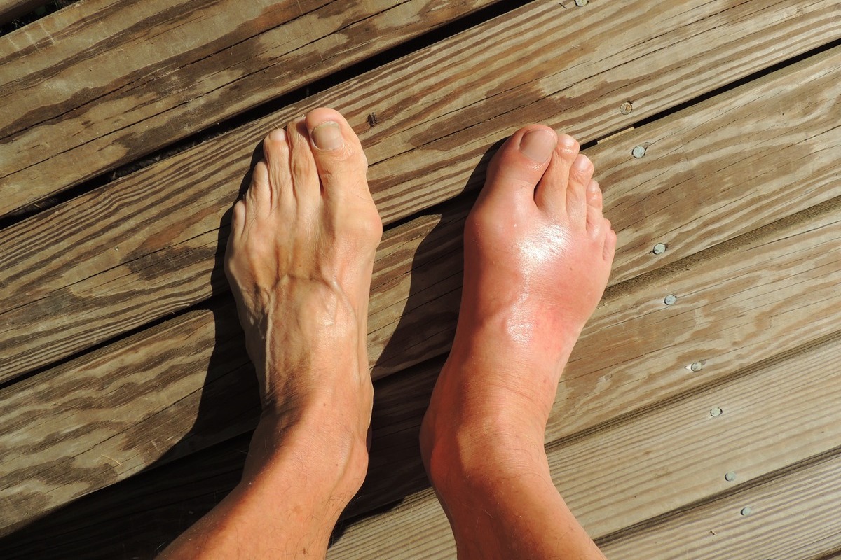 Joint Pain? I can help! Osteopath Paisley Pain Relief Services Glasgow