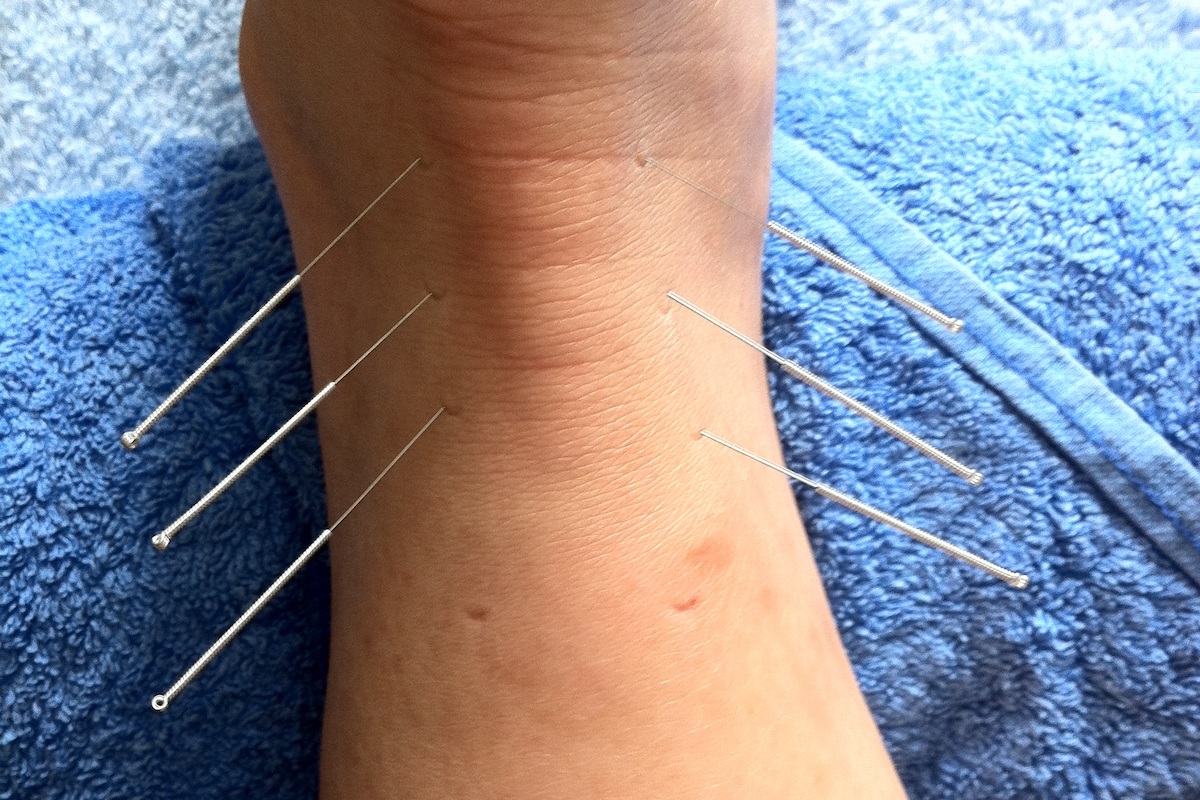 Sports Injury Treatments - Osteopath Paisley and Glasgow